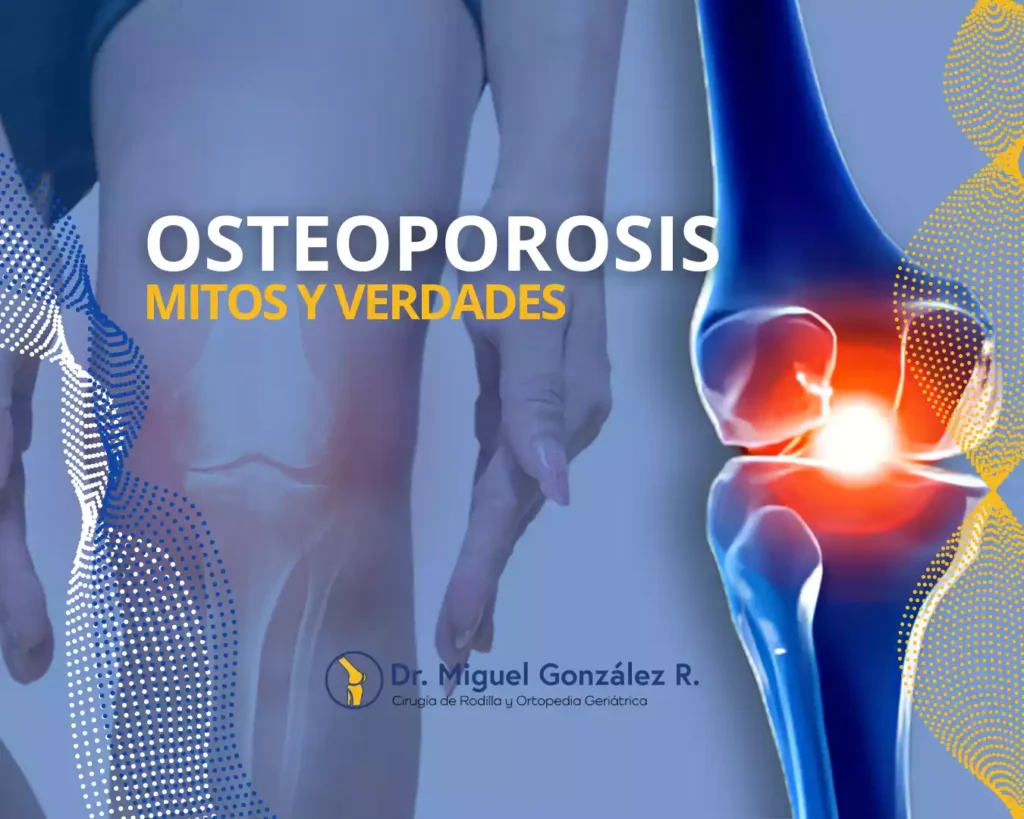 Osteoporosis: mitos y verdades