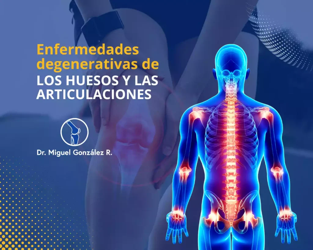 Enfermedades degenerativas de los huesos y las articulaciones | Dr Miguel Gonzalez