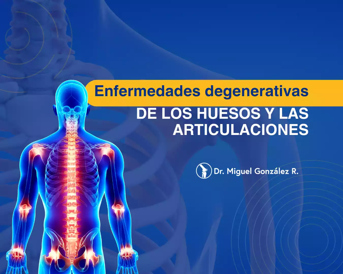 Enfermedades degenerativas de los huesos y las articulaciones