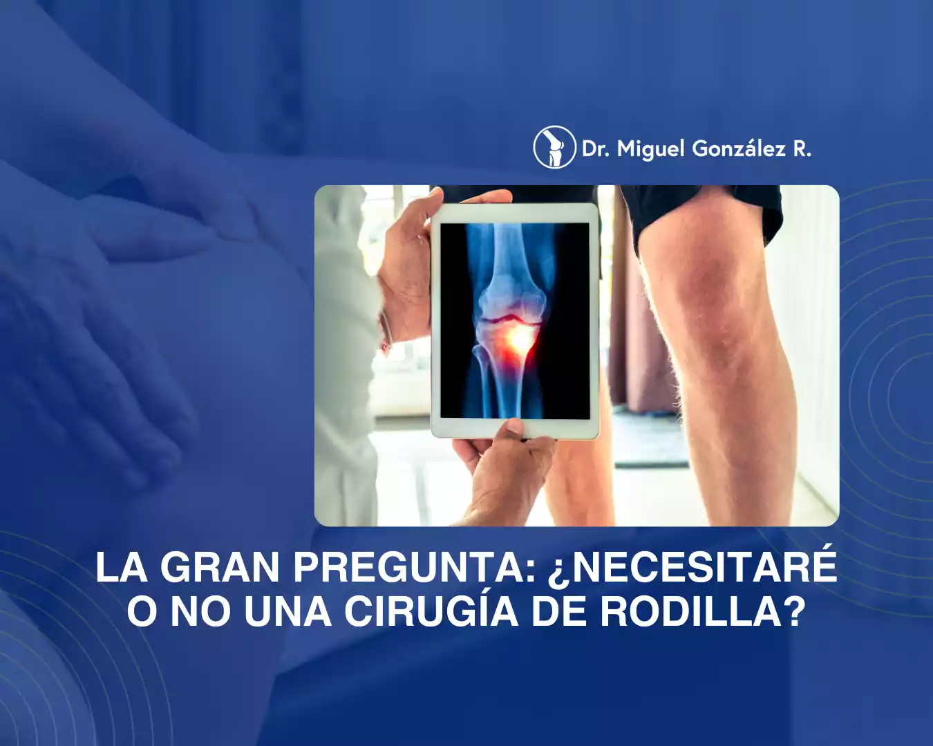 La Gran pregunta_ ¿Necesitaré o no una cirugía de Rodilla